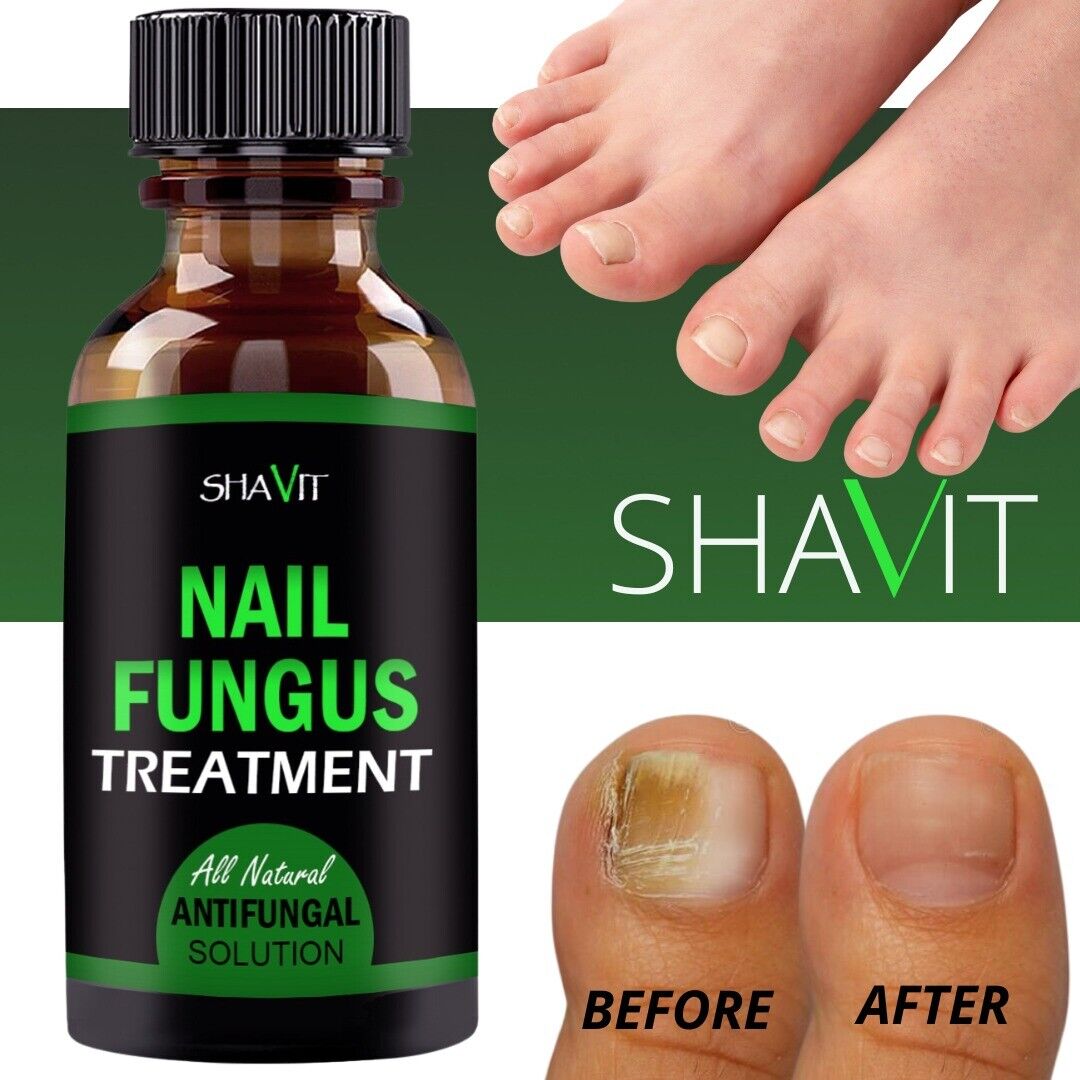 Extra Strength Fungal Treatment for Toenail & Athlete's Foot 4