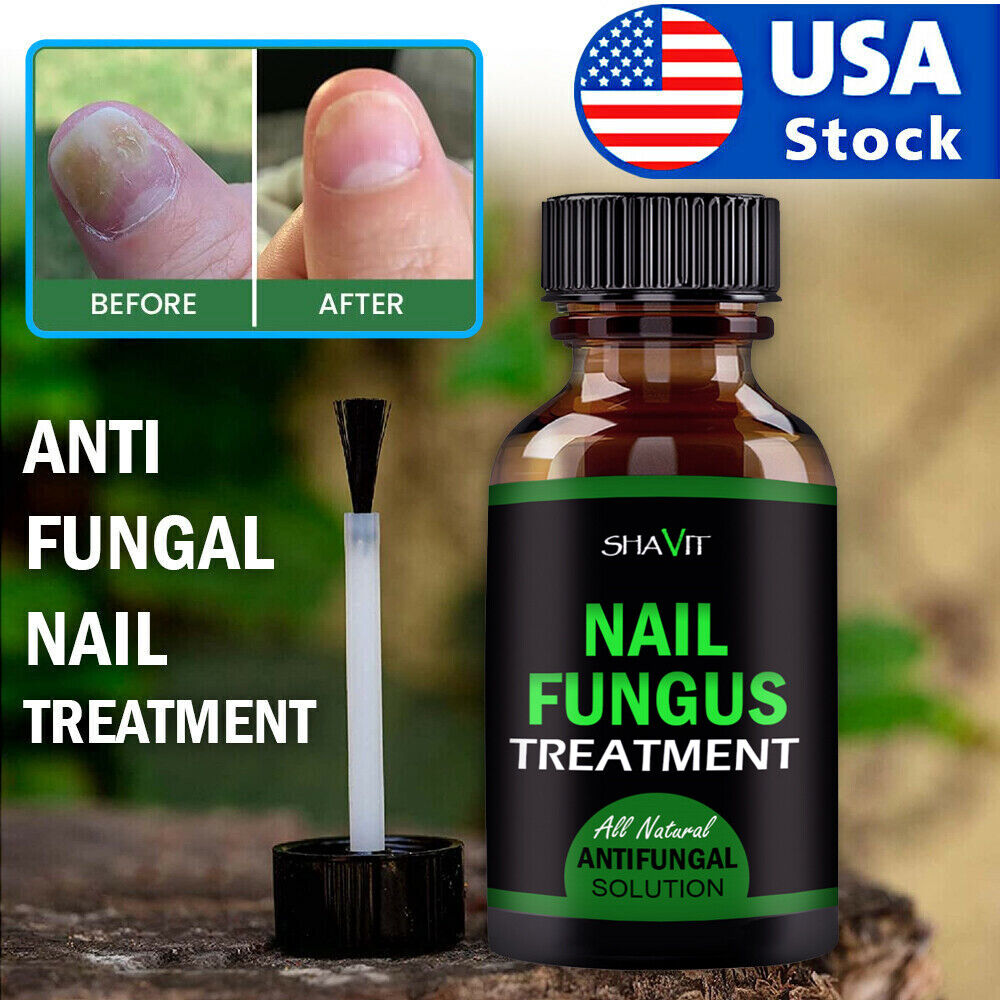 Extra Strength Fungal Treatment for Toenail & Athlete's Foot 6