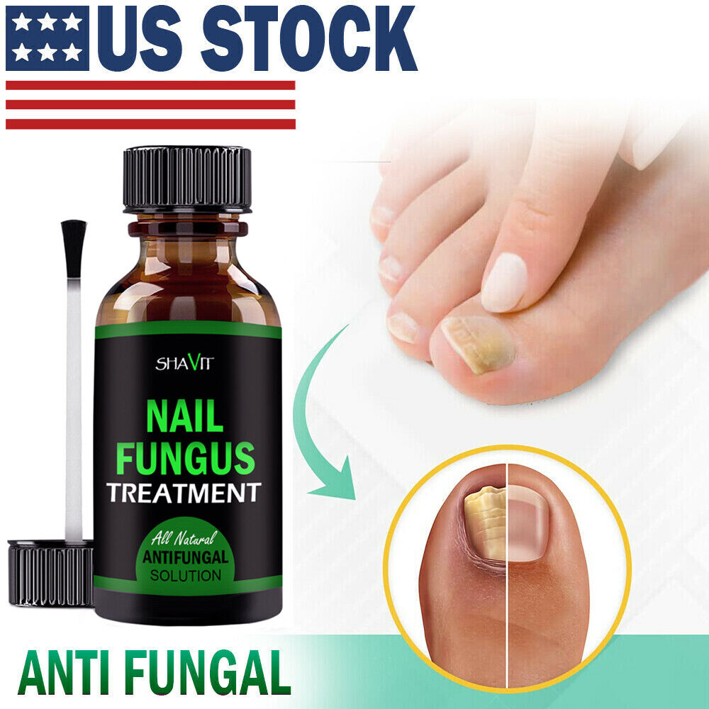 Extra Strength Fungal Treatment for Toenail & Athlete's Foot 2