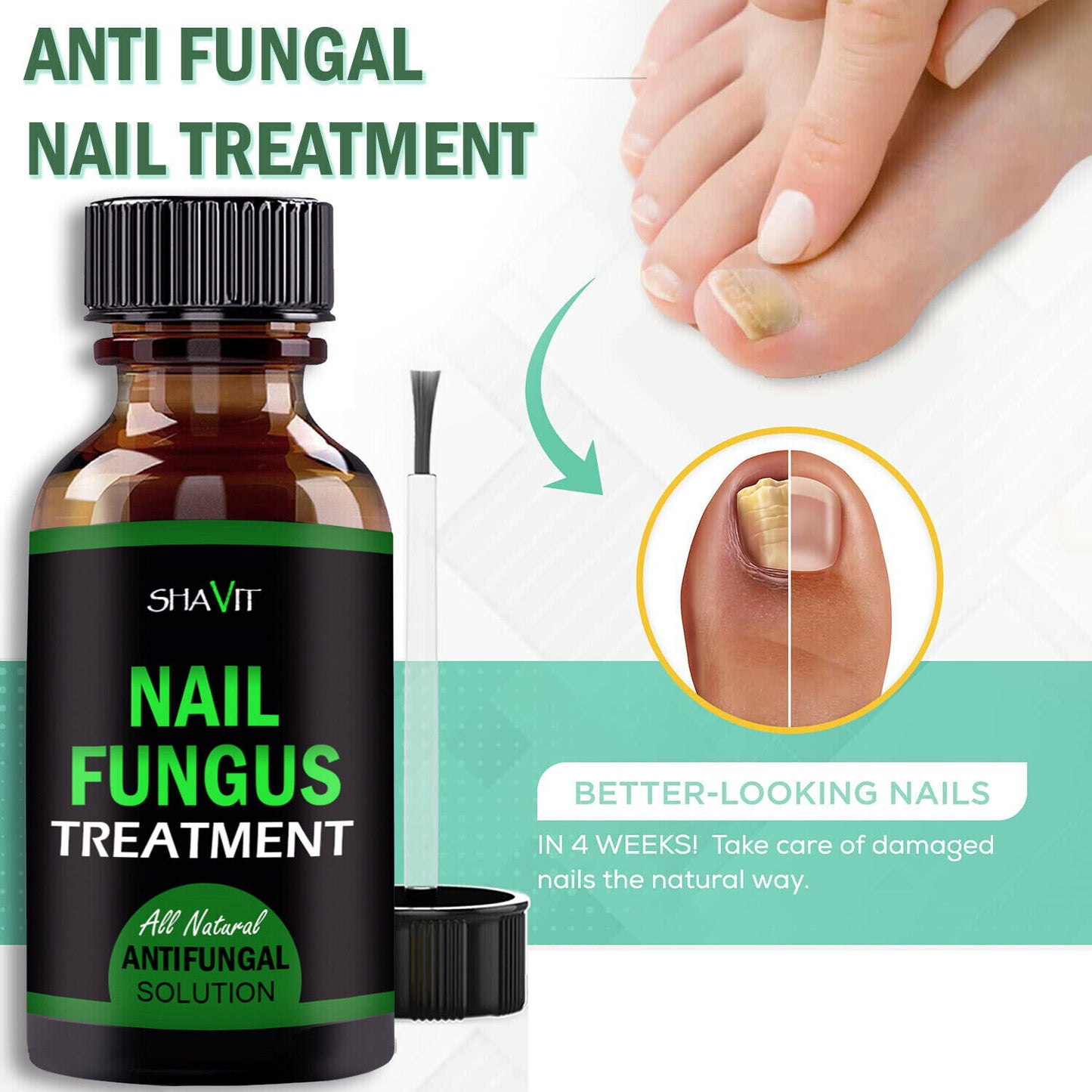 Extra Strength Fungal Treatment for Toenail & Athlete's Foot 8